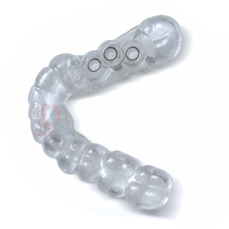 Surgical guide Print